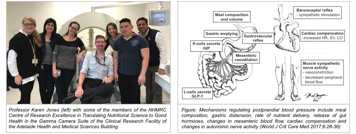 Professor Jones with members of the NHMRC CRE in Translating Nutritional Science to Good Health (left) and Mechanisms of postprandial hypotension (right)