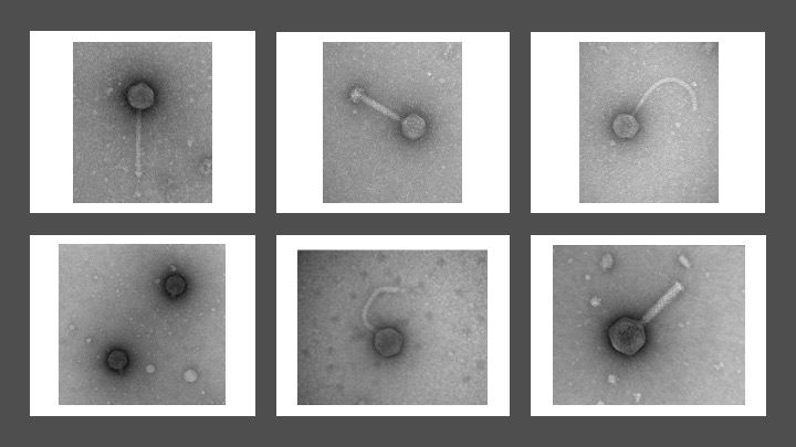 The Diverse World of Phages