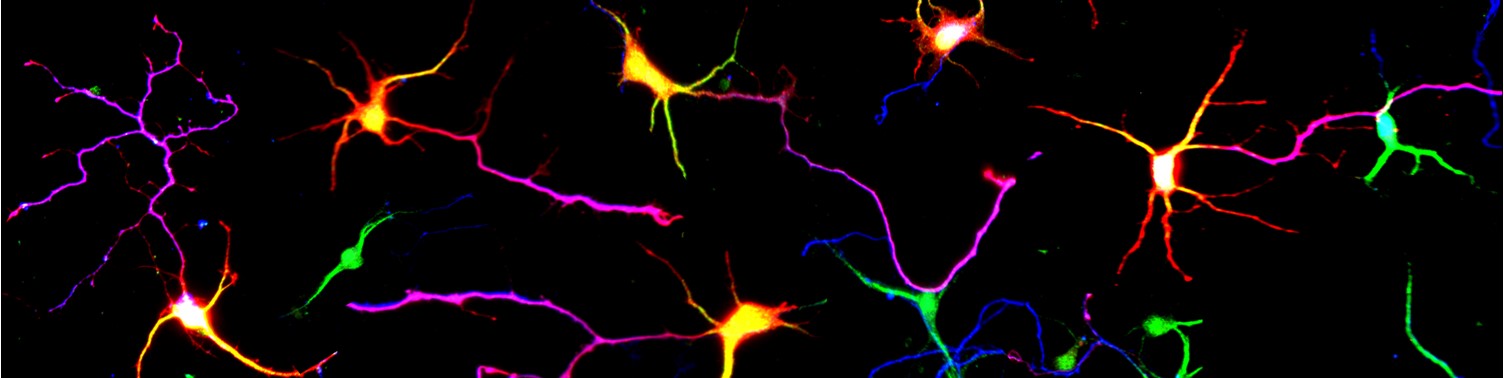 Neurons from mouse embryonic brain