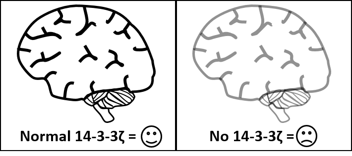 Brain Image