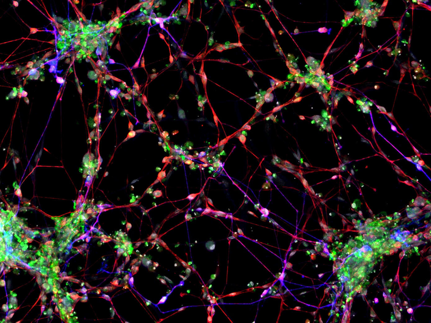 iNeurons Generated from Patient Fibroblasts over three weeks