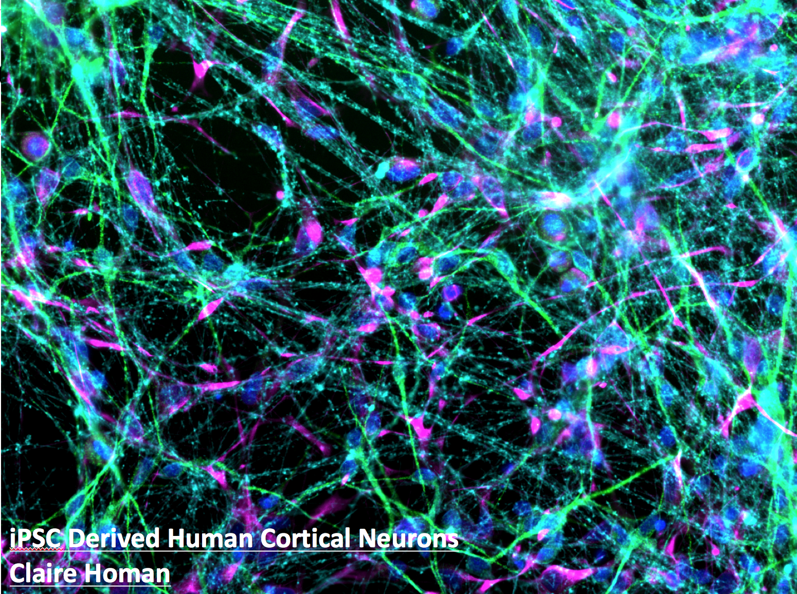 Image of iPS cell derived neurons.