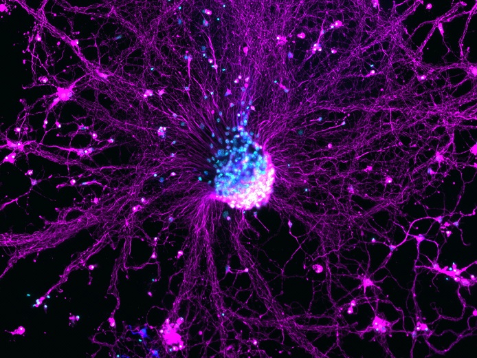 a sphere of cultured neural cells